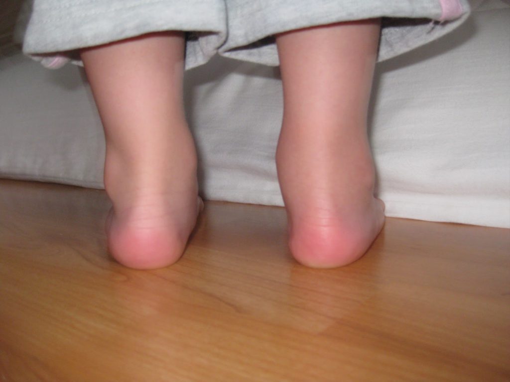 Почему у ребенка болят ноги после ОРВИ