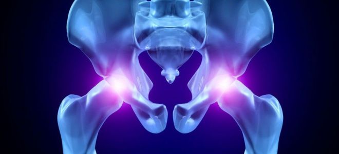 Симптомы и лечение остеохондроза тазобедренного сустава