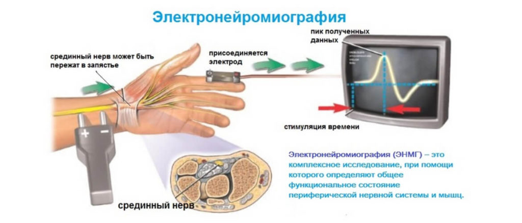 Двигательная моторная единица это