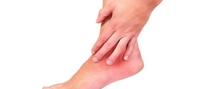 Причины болей в ногах и руках при остеохондрозе и их лечение