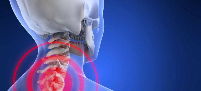 Шейный остеохондроз и панические атаки: взаимосвязь, симптомы и лечение