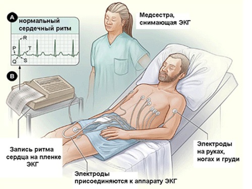 Электрокардиография