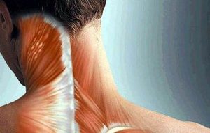 Фибродисплазия шеи