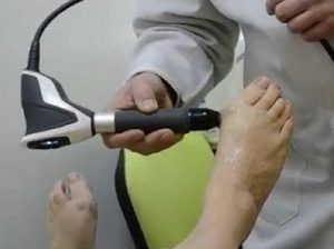 Физиолечение пальца ноги