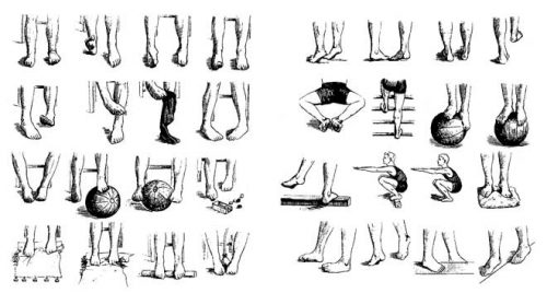 Гимнастика при вальгусной деформации стопы