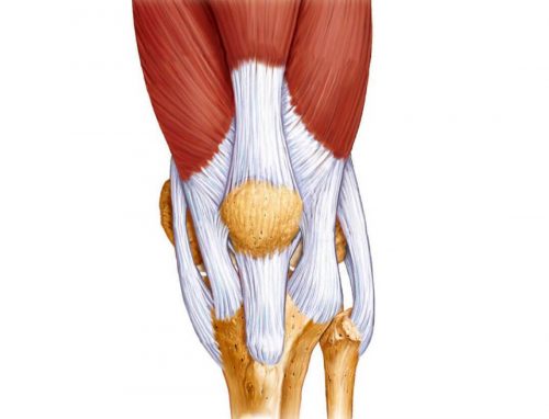Лигаментоз коленного сустава