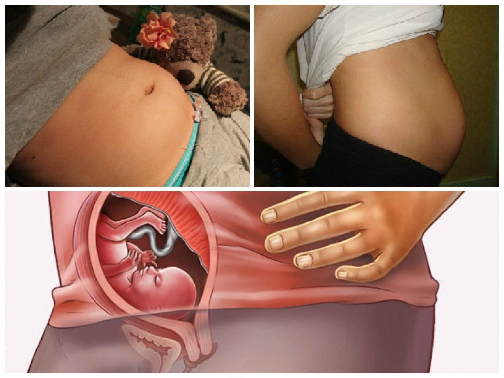 Первые шевеления при беременности форум. Шевеления ребёнка в животе.