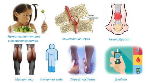 Причины судорог в ногах