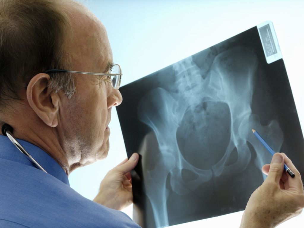 Рентген диагностика костей тазобедренного сустава