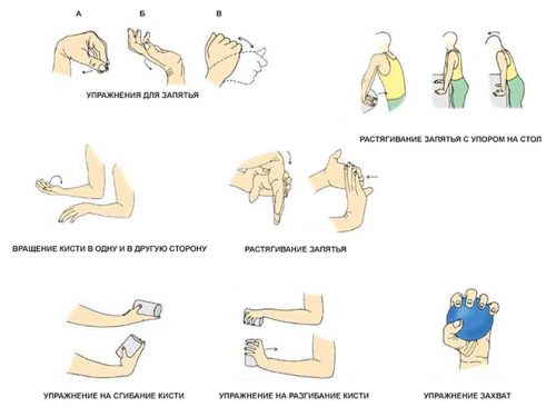 Упражнения при артрите рук