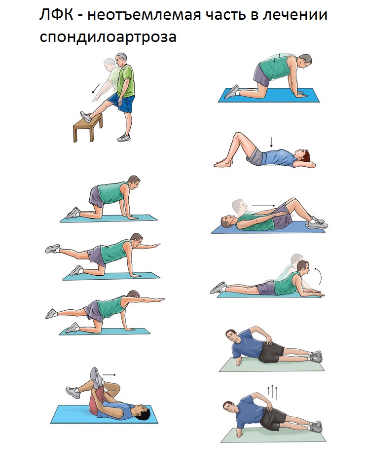 Упражнения при спондилоартрозе