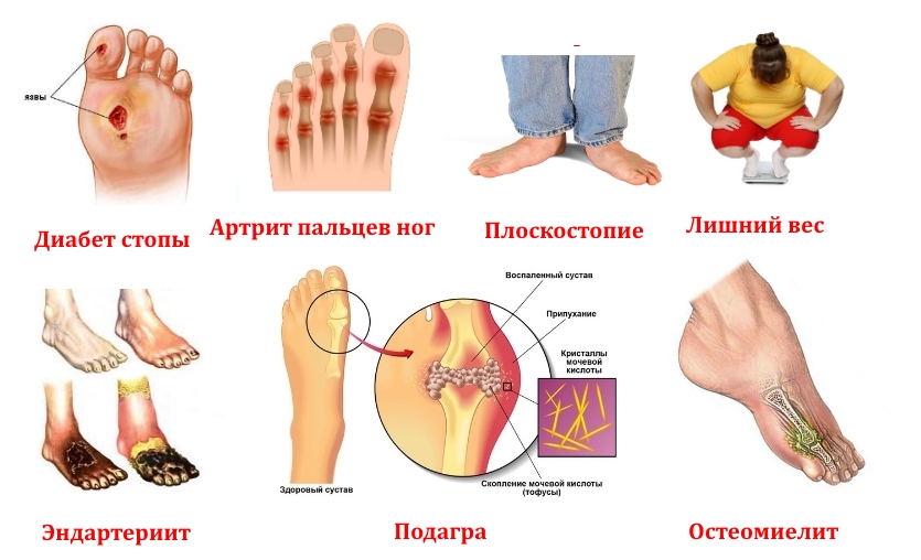 Заболевания — причины боли пальцев ног