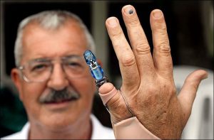Бионический протез пальца