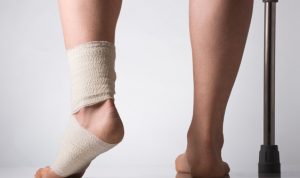 Последствие искривления пальцев ног в виде хромоты