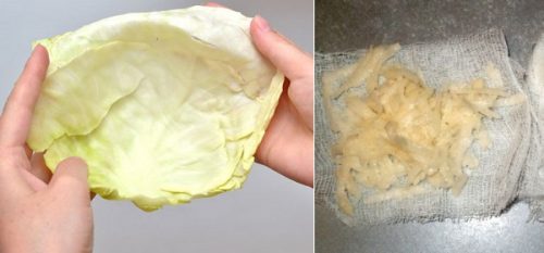 Капустный и картофельный компрессы