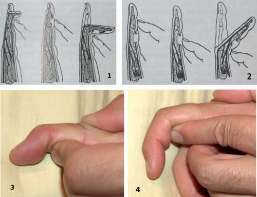 Первичная диагностика травмы пальца