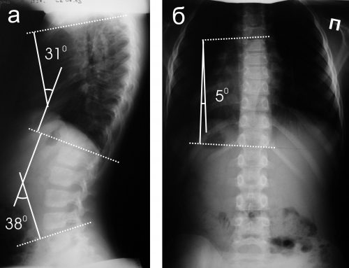 Проекции для рентгена грудного отдела