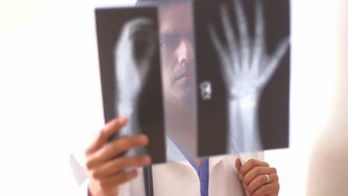 Рентген диагностика кистей рук