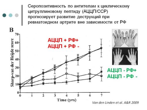 Серопозитивность ревматоидного артрита