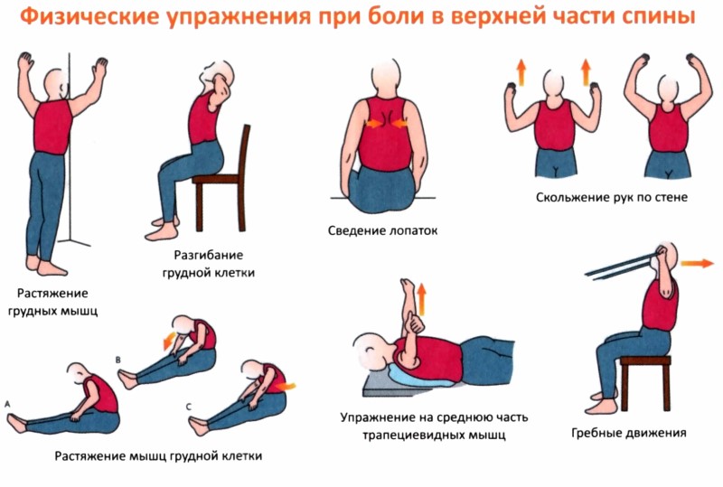 Упражнения при боли в верхней части спины