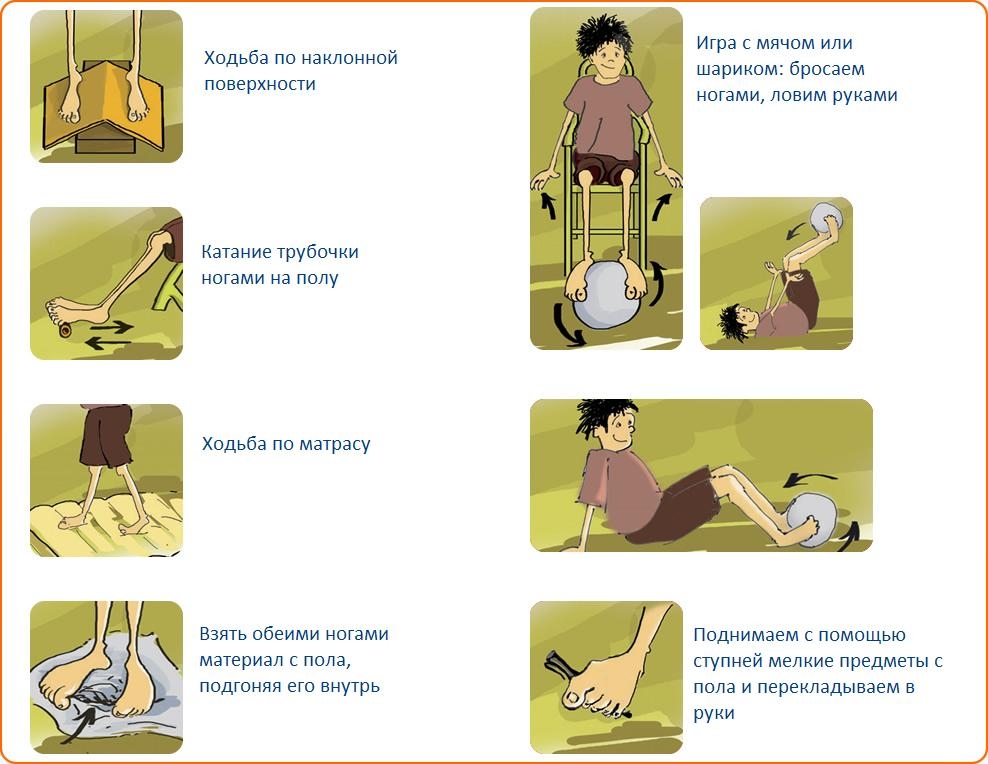 Упражнения при плоскостопии у детей