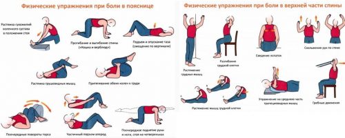 Упражнения при болях в спине